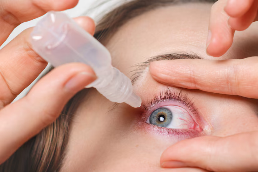 सूखी आंखें: कारण और उपचार