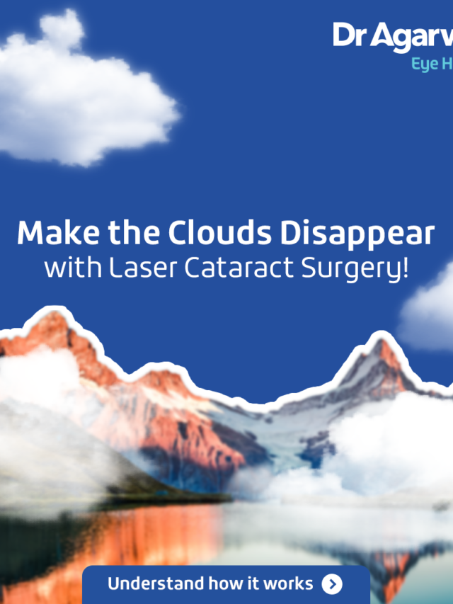 Make the Clouds Disappear with Laser Cataract Surgery