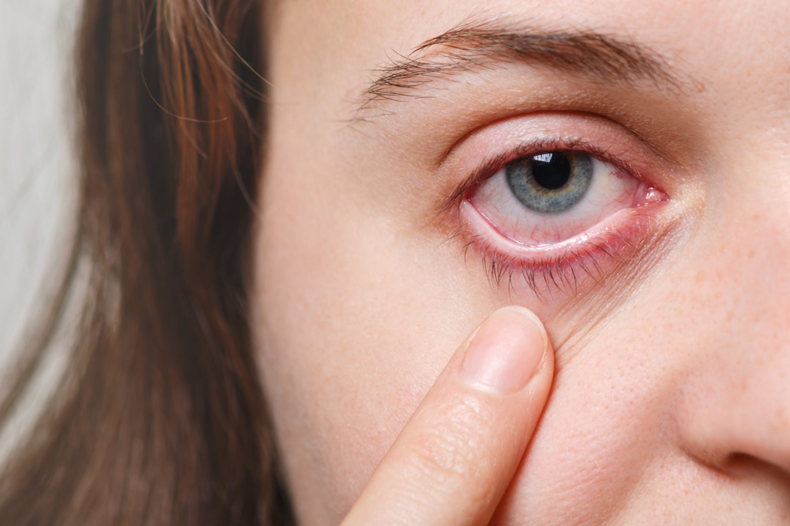 Choroiditis: Inflammatory Eye Disease and Treatment